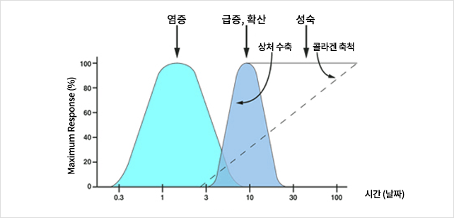 인대재생치료의 원리