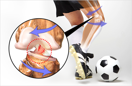 스포츠손상이란?