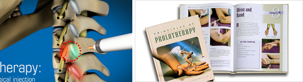 인대재생치료란?