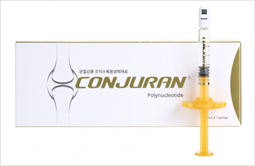 콘쥬란 연골주사